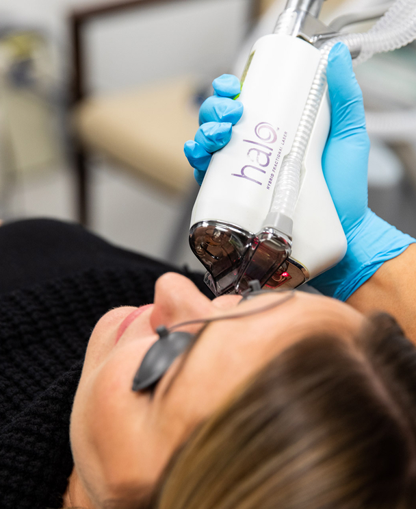 A HALO laser treatment at Laguna Aesthetics